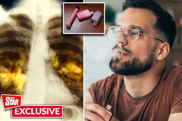 Scientists give stark warning on what vapers' lungs could look like in 10 years