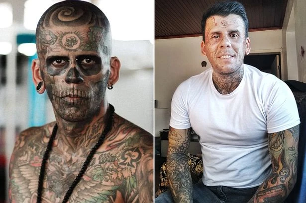 ‘Most tattooed man’s' 'excruciatingly painful’ transformation as ink removed