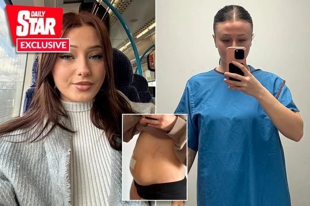 'I went to A&E thinking my appendix would burst but was sent home with paracetamol'