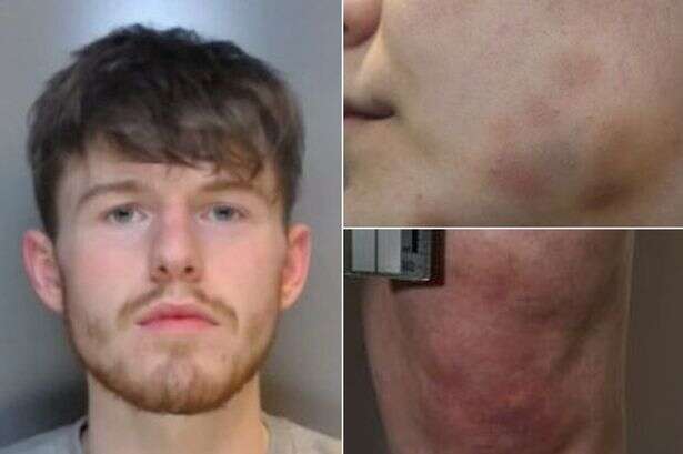 Thug tried to pull girlfriend's teeth out with pliers and threatened to drill eye out