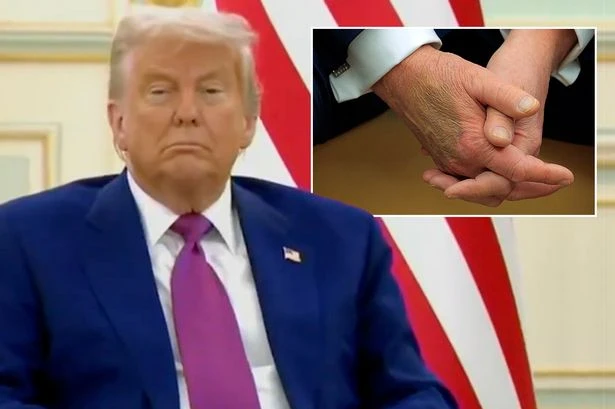 Truth behind Donald Trump 'dementia' claims as he falls asleep on camera