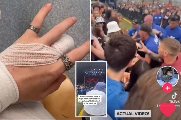 Moment girl celebrating GCSEs 'lost part of finger' in Reading Festival mosh pit