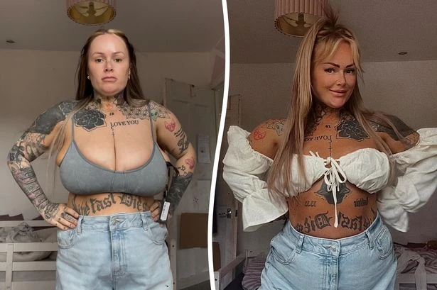 'My Quasimodo boobs were so big I couldn't even eat a meal - now my life is transformed'