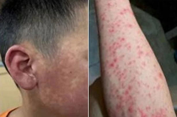 Horror pics of 'new Chinese pandemic' emerge as quarantine imposed after 10,000 cases