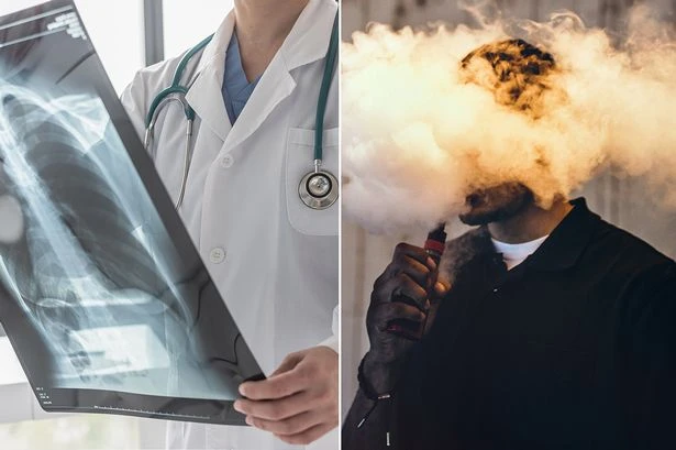 Where horrific medical condition 'popcorn lung' came from - and it's to do with a factory