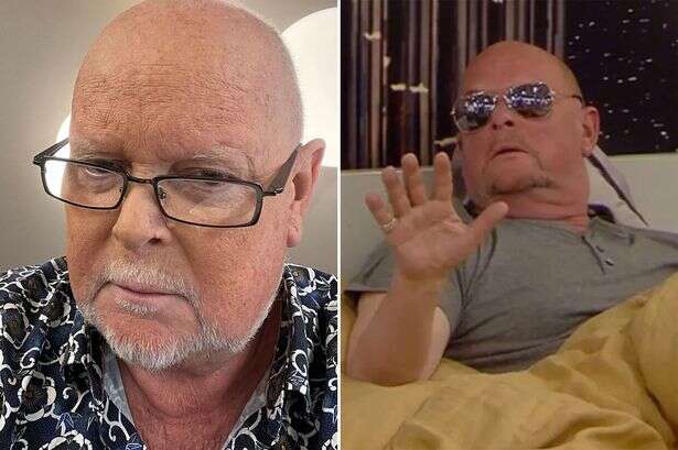 James Whale's health struggles as Big Brother star battles terminal cancer