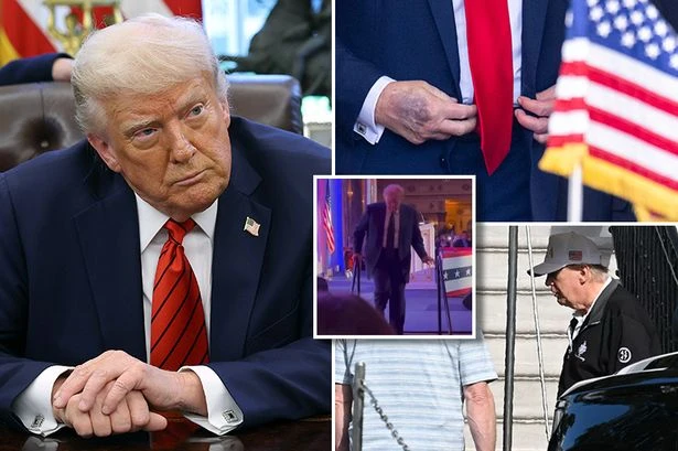 All of Trump's health issues ahead of 7pm mystery announcement as expert weighs in