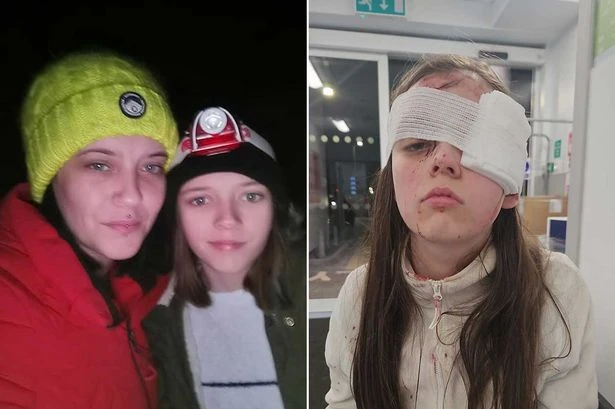 Horror deodorant can blast blinds schoolgirl as face dripped in blood from fire
