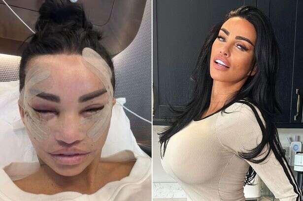 Concerned Katie Price fans beg her to stop plastic surgery as she shares facelift update