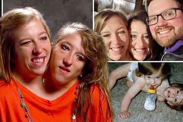 Conjoined twins Abby and Brittany Hensel spark pregnancy rumours after 'secret marriage'