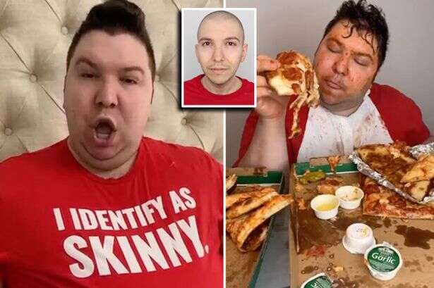 YouTuber Nikocado Avocado has major surgery after shocking world with 250-pound weight loss