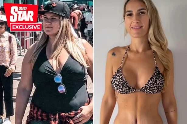 I lost 120lbs but then realised how much skin I needed to lose – this is how I did it