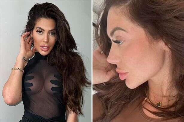 Chloe Ferry shows off 'new face' after botched surgery that 'ruined her life'