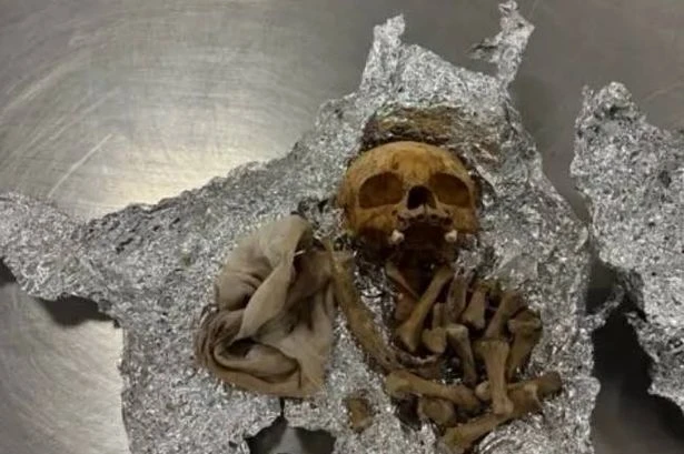 Airport staff make grim find as man caught with human skull and bones in suitcase