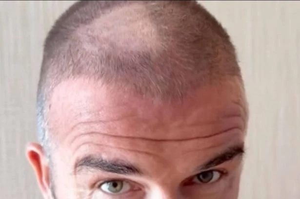 David Beckham left red-faced with huge bald patch after DIY haircut blunder