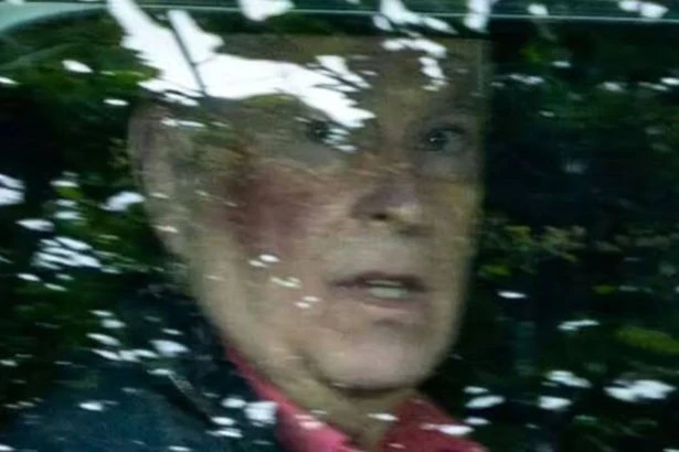 Royal insiders breaks silence over Prince Andrew's bruised face as mystery grows