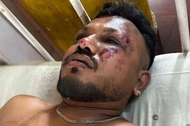 Air India crash survivor accused of lying as famous actor's comments spark backlash