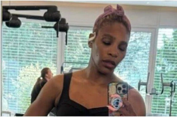 Serena Williams flaunts ripped abs as she shows off incredible body transformation