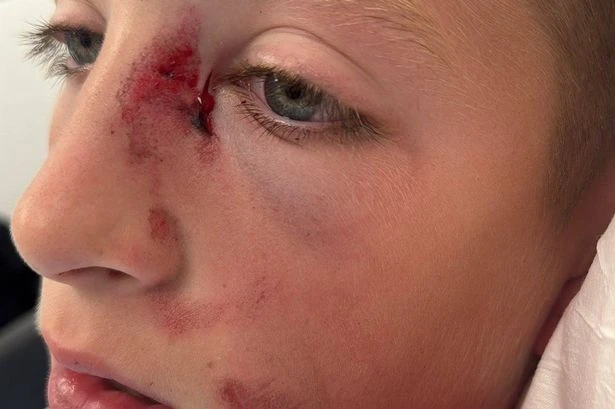 Boy laid on floor squealing with blood all over after horror hit-and-run
