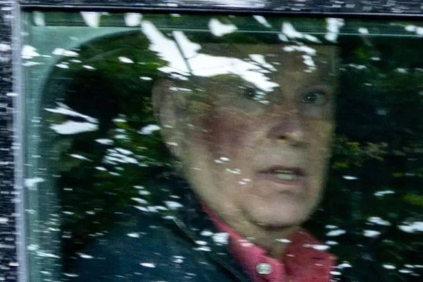 Andrew Mountbatten-Windsor's bruised face explained by medical condition