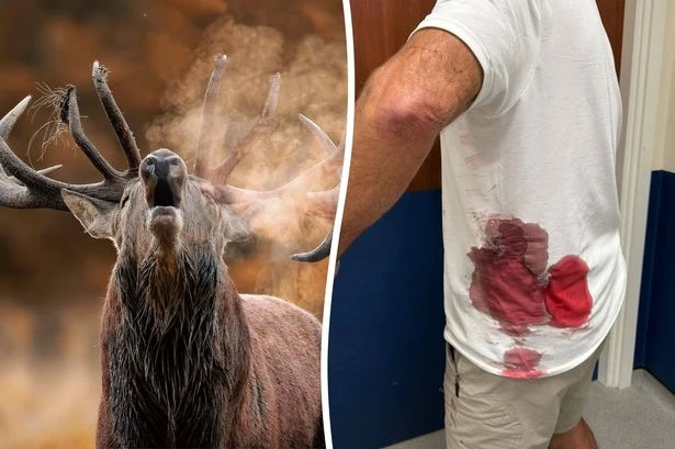 Grandfather gored by rampaging stag in horror attack while walking through park