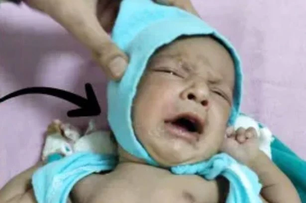 Newborn left to die as she's found with stone in mouth and lips glued shut