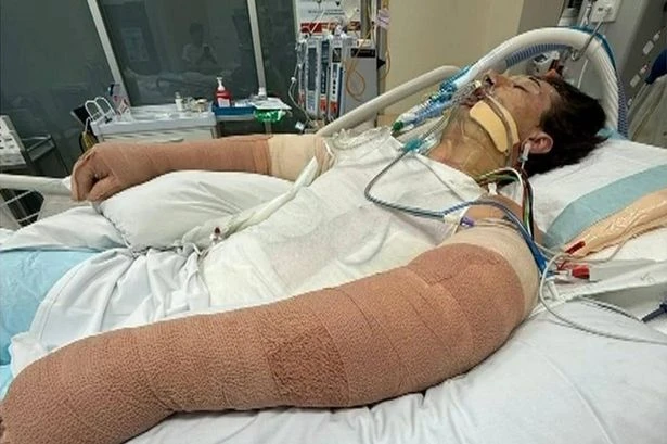 Freak 'robot vacuum explosion' sparks blaze leaving man fighting for life