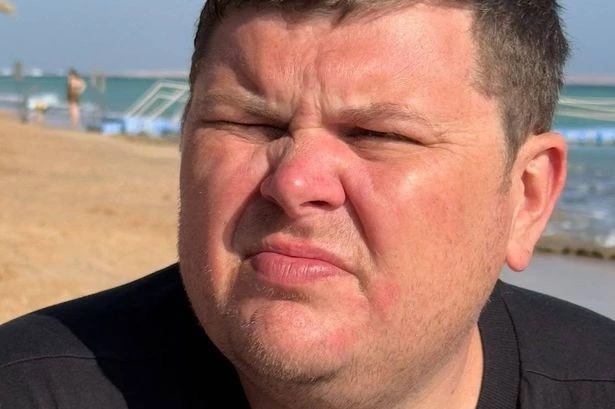 'I was nearly burned alive in my five-star hotel room as lamp threw me to the floor'