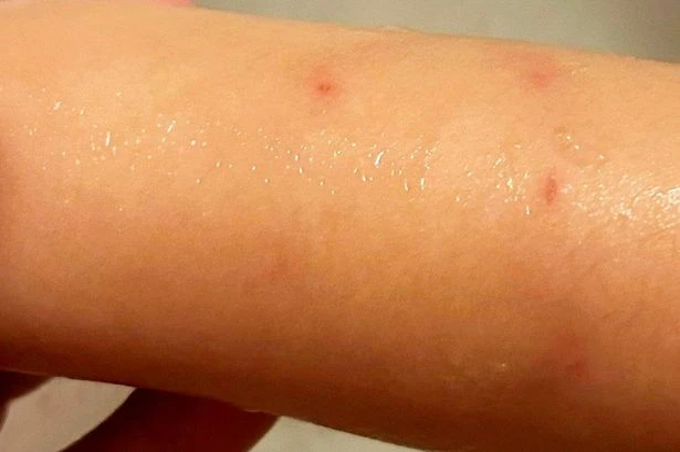 Nursery manager who bit child and blamed it on kid narrowly avoids jail