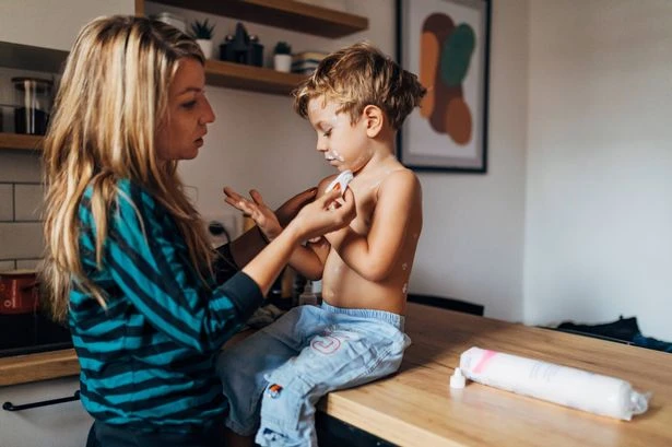 Warning for Brits on summer breaks as measles risk soars to 30-year high across Europe