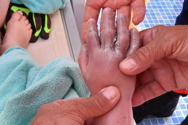 Horror as Brit boy, 4, has 'arm sucked into pipe' while playing in Majorca swimming pool