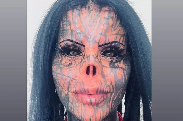Woman who had nose chopped off keeps it in a jar – and people are scared of her