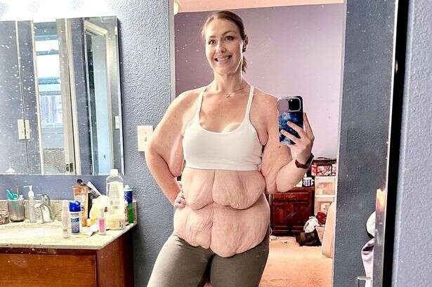 Woman who comfort ate to be XXXXXL sheds 15st after cancer scare