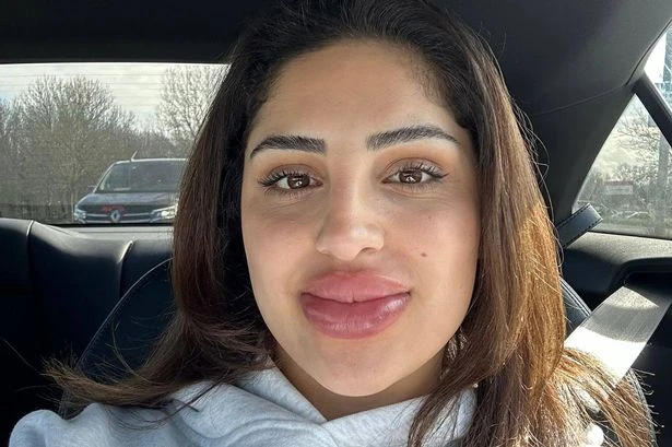 Woman's lip filler dissolving treatment goes wrong and she's left looking like Bratz doll