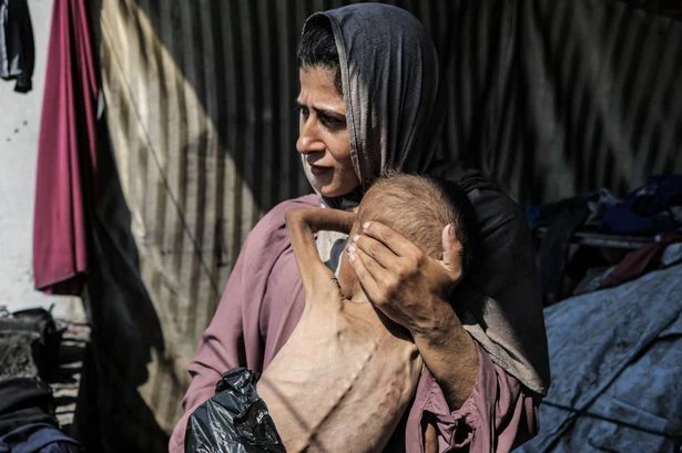 Keir Starmer to hold urgent Gaza talks as emaciated kids images sicken world