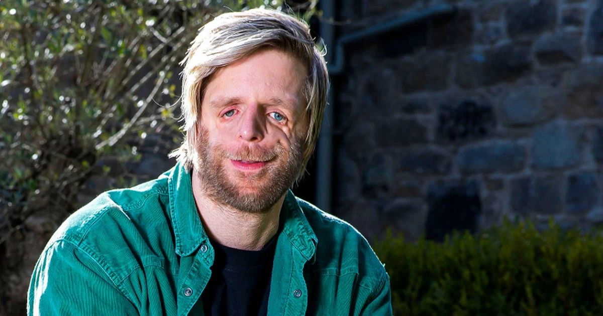 opinionTODAY'S TV WITH SARA WALLIS: A man set on fire by his uncle is treated in Love My Face