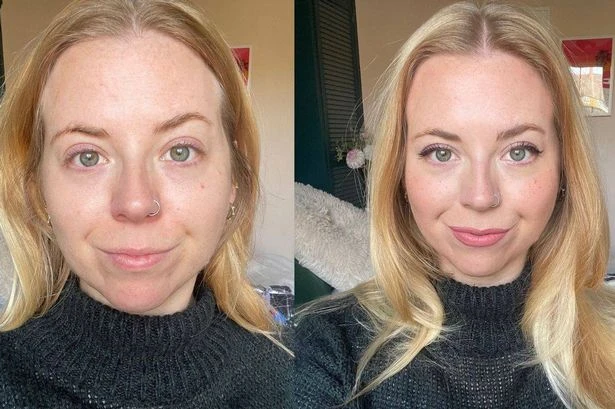 'This £29 cream erased my redness fast - it's now £21 for Amazon Prime Day'