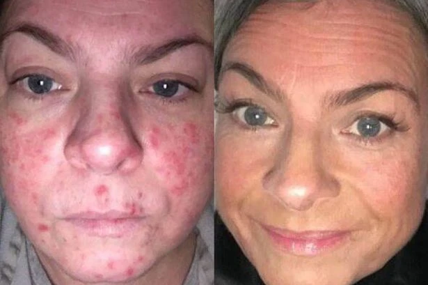 Heatwave friendly SPF that's dermatologist-approved and gives shoppers 'more confidence'