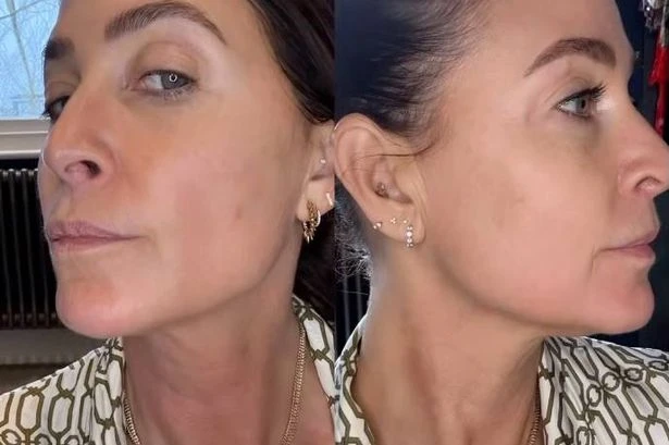 Lisa Snowdon-approved neck firming serum is 'magic in a bottle' according to fans