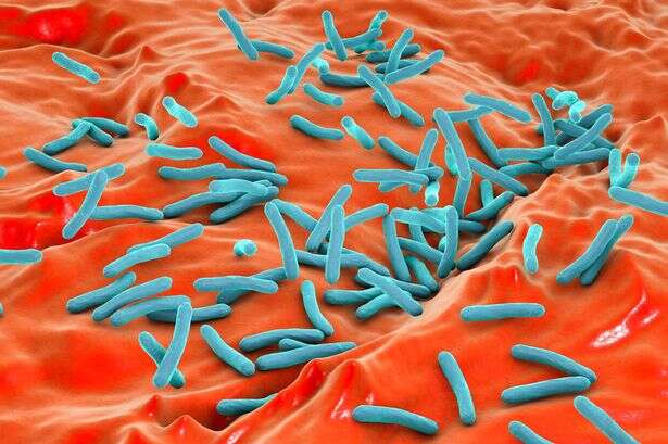 Surge in cases of Victorian superbug as Midlands named among hotspots