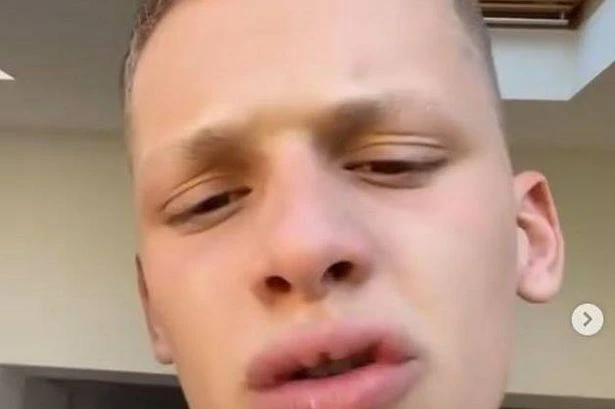 Freddy Brazier misses flight after being 'punched and fined'
