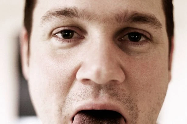 Dentist sheds light on condition turning tongues black and hairy