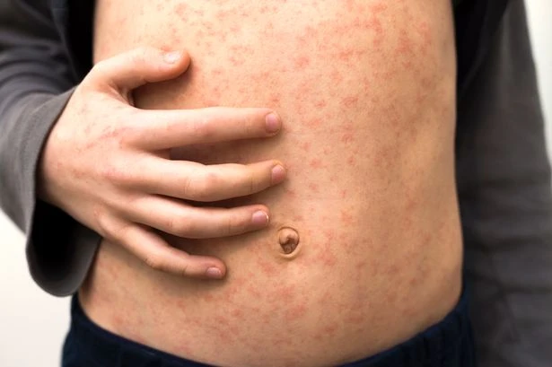 Shocking health stat as Midland four-year-olds start school next week