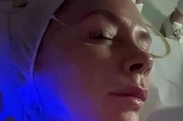 Victoria Beckham shares results of 'mini lift' face treatment she swears by