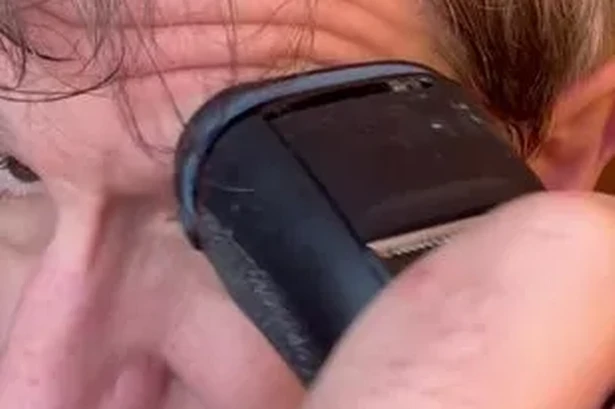 Louis Theroux shaves eyebrows amid health battle as celebrity pals rush to support him