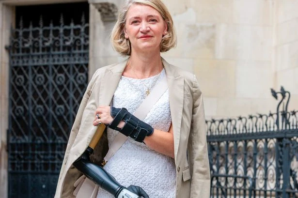Mum loses arm and leg after slipping on station platform into path of two trains