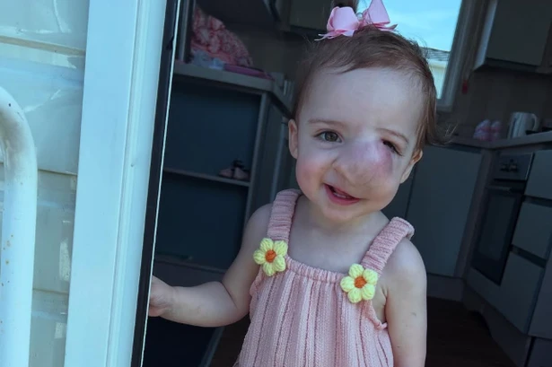 Little girl dies of cancer after doctors 'assume lump on face was caused by parents'