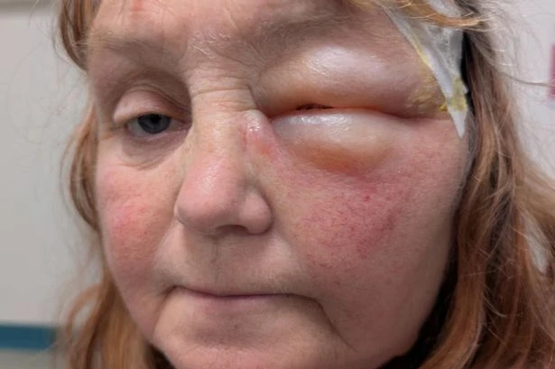 Gran suffers horror burns as neighbour throws boiling water on her while she's with grandson