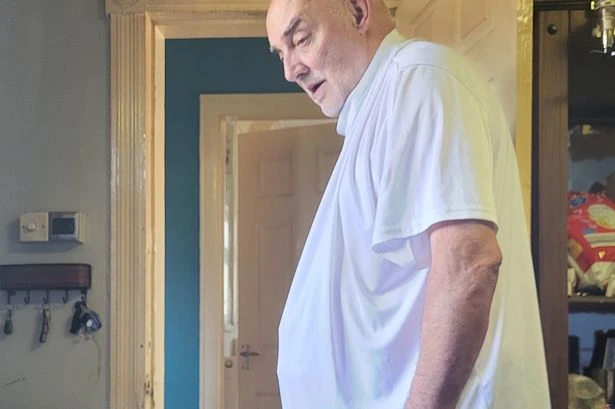 Dad, 65, whose hernia ballooned to size of football wins payout after suing NHS