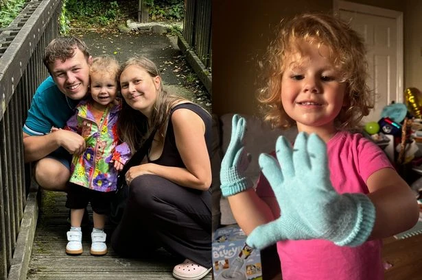 'Amazing' girl, 3, loses fingers and toes to life-threatening condition